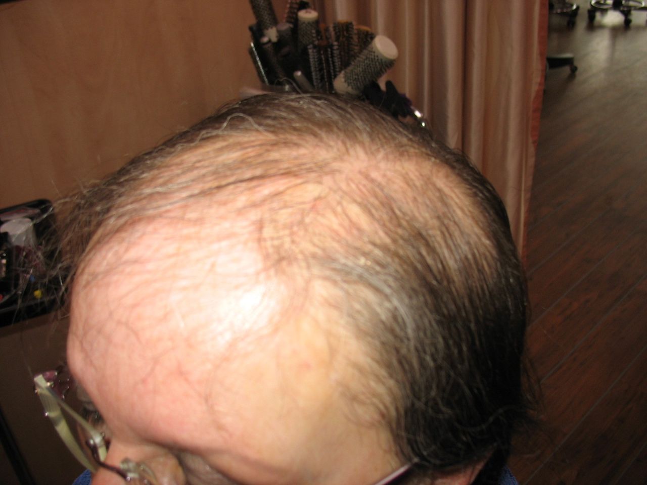 Zweithaarintegration Hieske Haarfantasien 2023-09-22 22:07:03