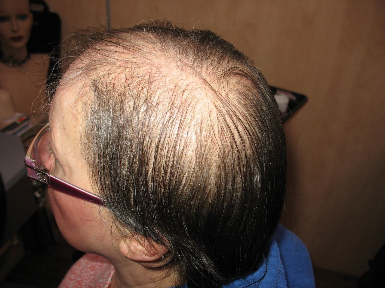 Zweithaarintegration Hieske Haarfantasien 2023-09-22 22:07:03